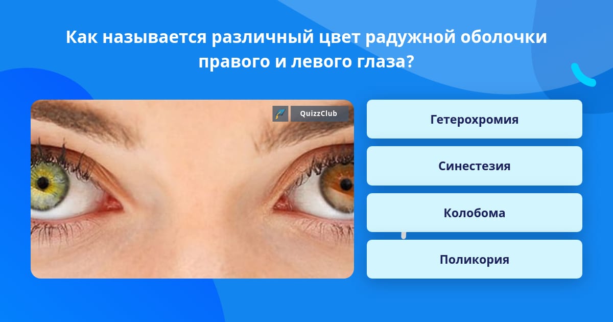 Колобома радужной оболочки глаза. Как называют людей с разными глазами. Как называются разные цвета для глаз красит.