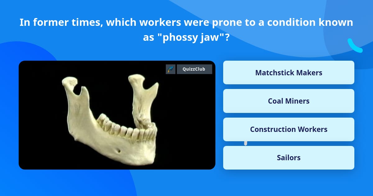 New Morbid Terminology: Phossy Jaw, The Occupational Disease of Matchstick  Makers