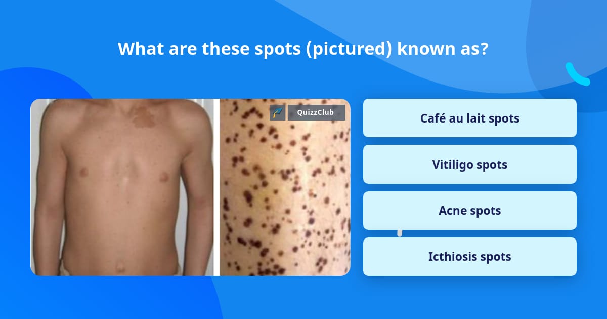 What are these spots (pictured)... | Trivia Questions | QuizzClub